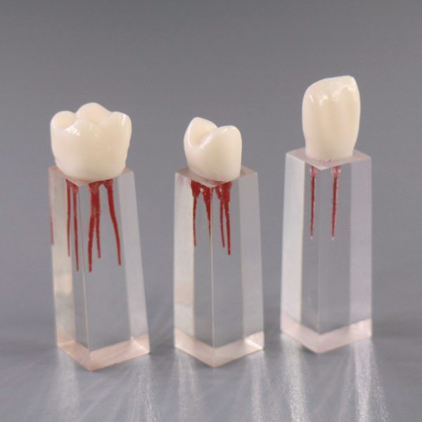Dent Model Endodontic Teeth Models – Jojenmodel-dental model teeth,dental ...
