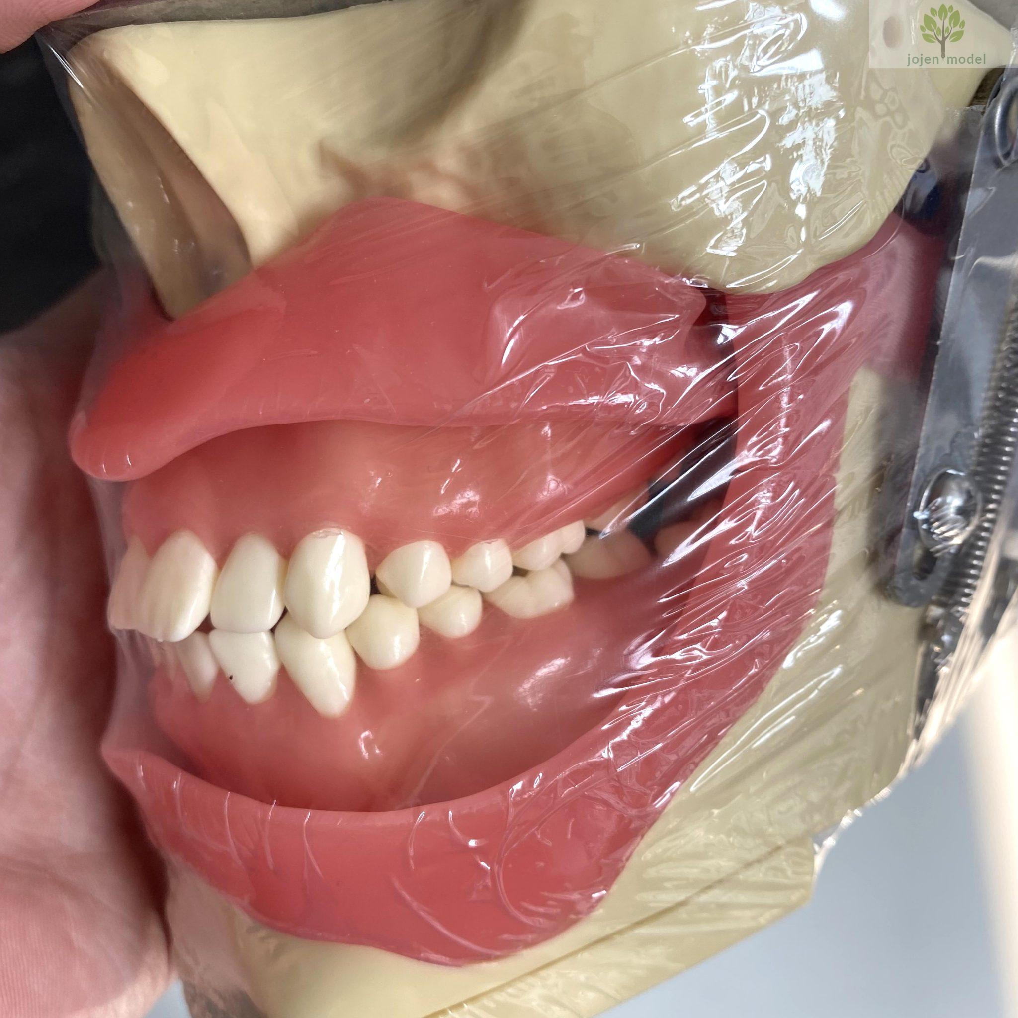 Conduction Anesthesia Model Jojenmodeldental model teeth,dental