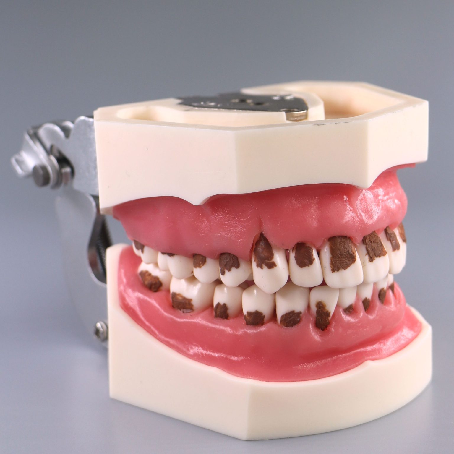 Periodontal Jaw Model – Jojenmodel-dental model teeth,dental simulation ...