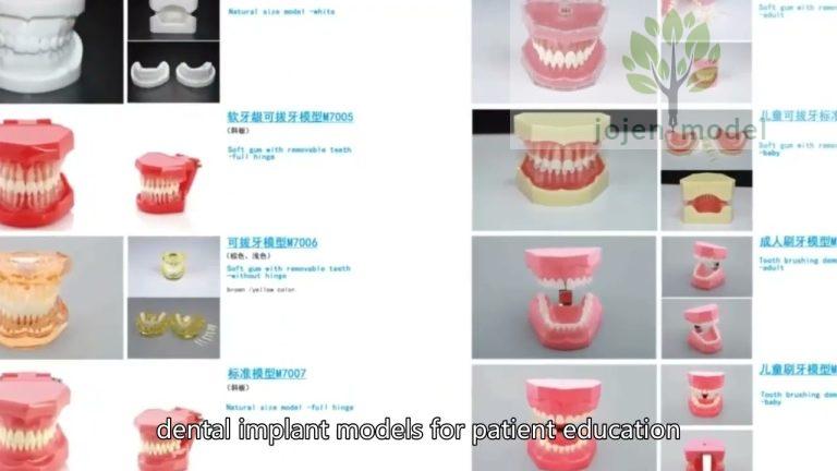 Dental Orthodontic Typodont Model - Implant & Denture Restoration Practice Model